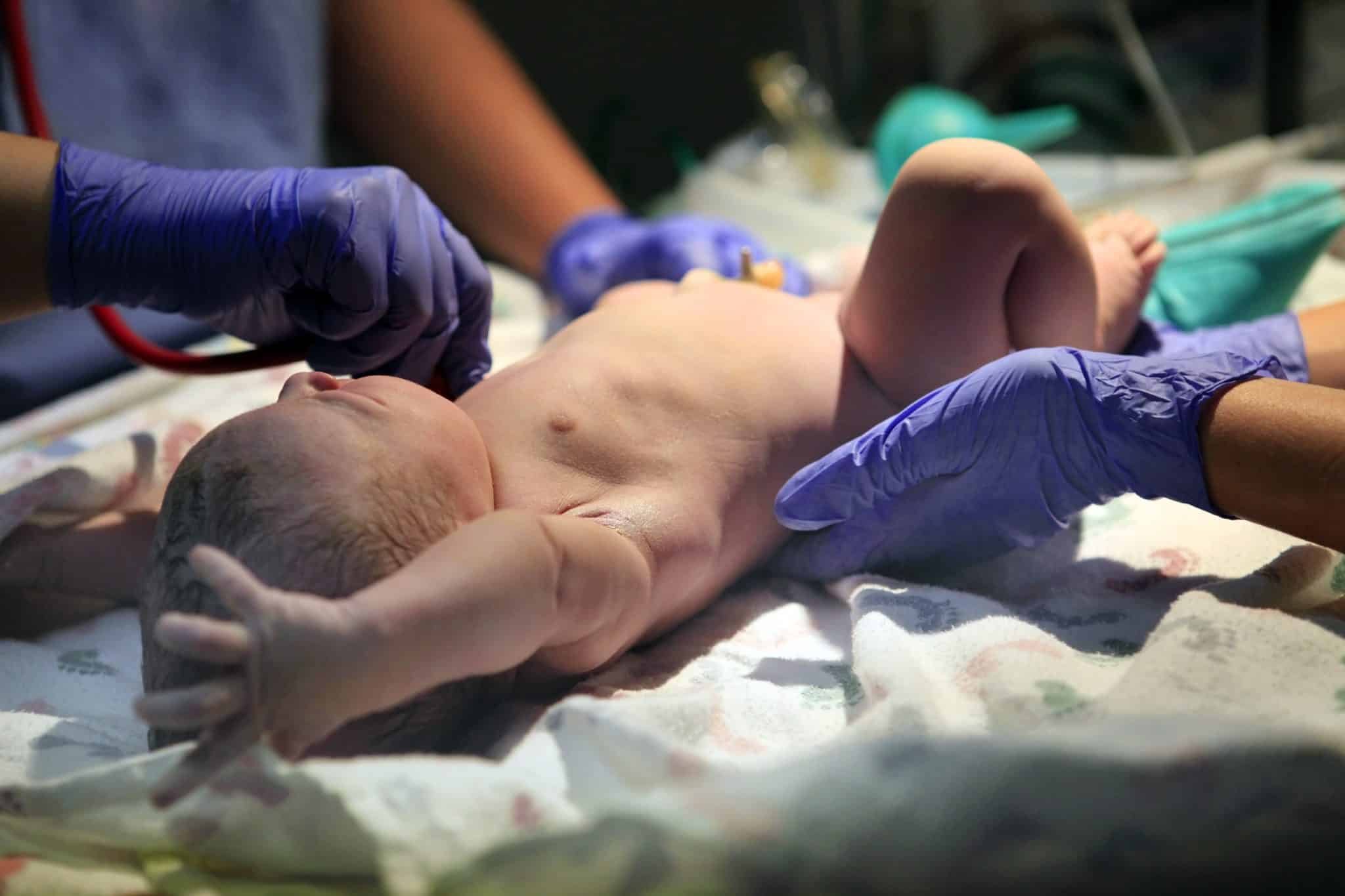 Birth Injury